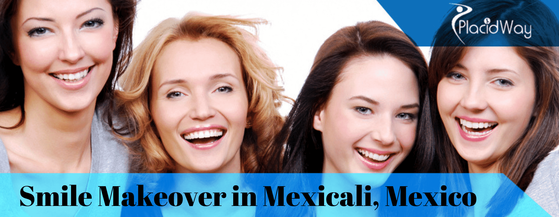 Smile Makeover in Mexicali, Mexico